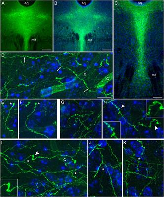 An experimental platform for stochastic analyses of single serotonergic fibers in the mouse brain